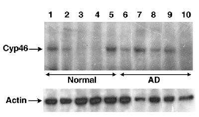 Western Blot: CYP46A1 Antibody [NB400-140]