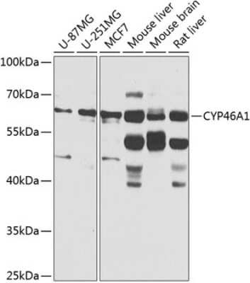 Western Blot: CYP46A1 AntibodyBSA Free [NBP2-92925]