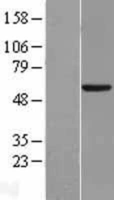 Western Blot: CYP46A1 Overexpression Lysate [NBL1-09694]