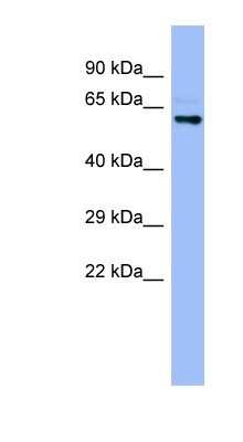 Western Blot: CYP4A22 Antibody [NBP1-80496]