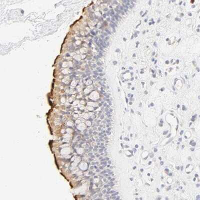 Immunohistochemistry-Paraffin: CYP4B1 Antibody [NBP1-86142]