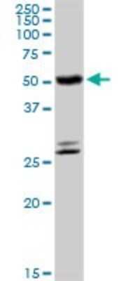 Western Blot: CYP4B1 Antibody [H00001580-D01P]