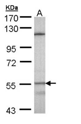 Western Blot: CYP4B1 Antibody [NBP1-32691]