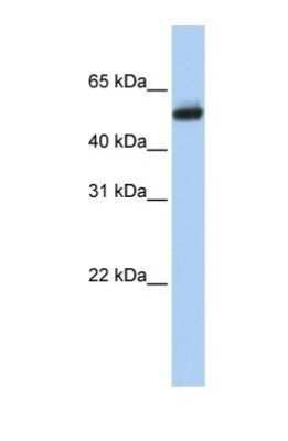 Western Blot: CYP4B1 Antibody [NBP1-69677]