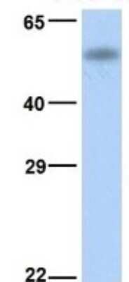 Western Blot: CYP4B1 Antibody [NBP1-69677]