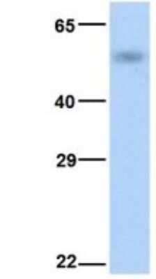 Western Blot: CYP4B1 Antibody [NBP1-69677]