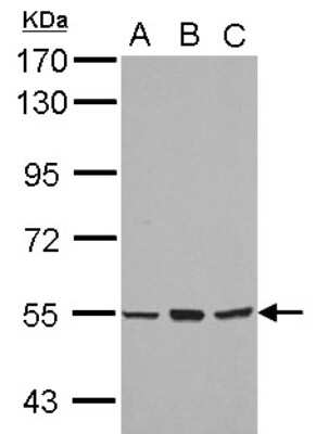 Western Blot: CYP4B1 Antibody [NBP2-16068]