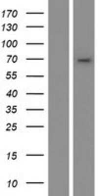 Western Blot: CYP4B1 Overexpression Lysate [NBL1-09696]