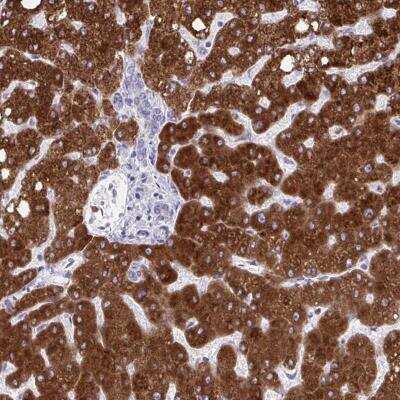 Immunohistochemistry-Paraffin: CYP4F2 Antibody [NBP2-46854]