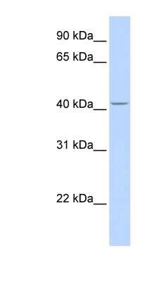 Western Blot: CYP4F12 Antibody [NBP1-62396]