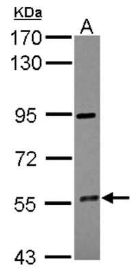 Western Blot: CYP4F12 Antibody [NBP2-16069]