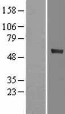 Western Blot: CYP4F12 Overexpression Lysate [NBL1-09698]