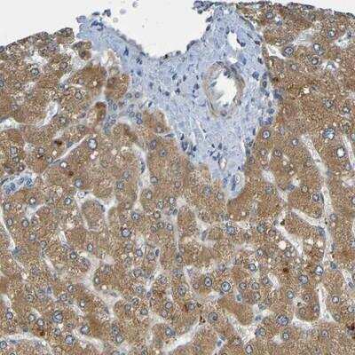 Immunohistochemistry: CYP4F2 Antibody [NBP1-86461]