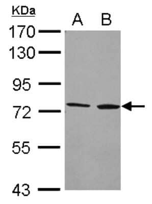 Western Blot: CYP4F2 Antibody [NBP2-16070]