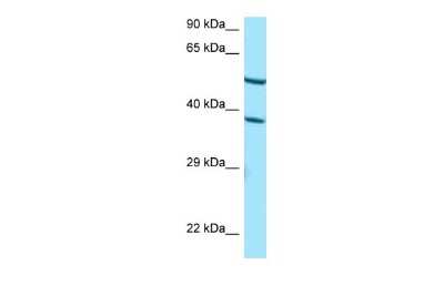 Western Blot: CYP4F2 Antibody [NBP2-87240]