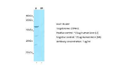 Western Blot: CYP4F2 Antibody [NBP2-87240]