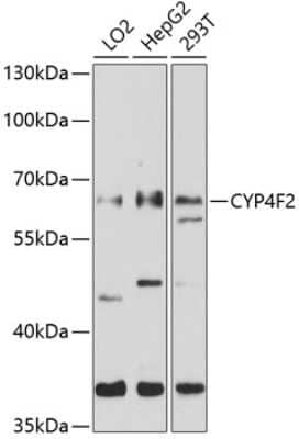 Western Blot: CYP4F2 AntibodyBSA Free [NBP2-91998]