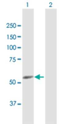 Western Blot: CYP4F22 Antibody [H00126410-D01P]