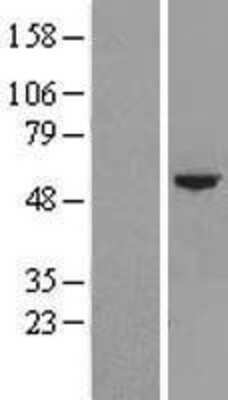 Western Blot: CYP4F22 Overexpression Lysate [NBL1-09699]