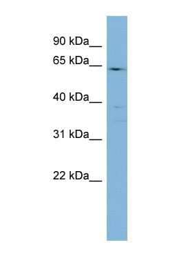 Western Blot: CYP4F3 Antibody [NBP1-69678]