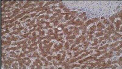 Immunohistochemistry: CYP4V2 Antibody (M29-P3B10) - BSA Free [NBP2-50214]