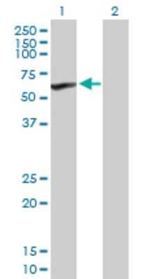 Western Blot: CYP4V2 Antibody [H00285440-B01P]