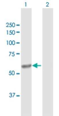Western Blot: CYP4V2 Antibody [H00285440-D01P]