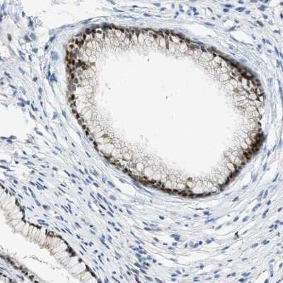 Immunohistochemistry-Paraffin: CYP4X1 Antibody [NBP2-13896]