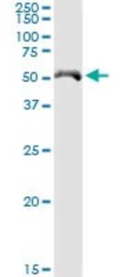 Western Blot: CYP4X1 Antibody [H00260293-D01P]