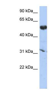 Western Blot: CYP4X1 Antibody [NBP1-62382]