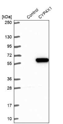 Western Blot: CYP4X1 Antibody [NBP2-13896]