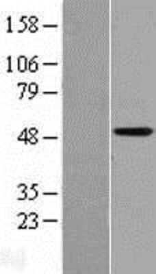 Western Blot: CYP4X1 Overexpression Lysate [NBP2-04994]