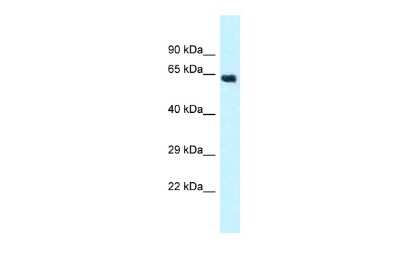 Western Blot: CYP4Z1 Antibody [NBP2-83989]