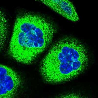 Immunocytochemistry/ Immunofluorescence: CYP51A1 Antibody [NBP2-48733]