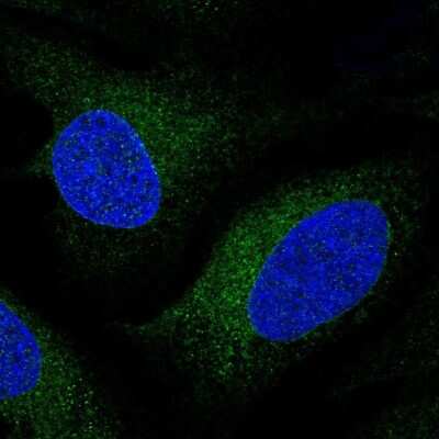 Immunocytochemistry/ Immunofluorescence: CYP51A1 Antibody [NBP2-48793]