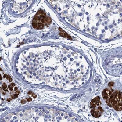 Immunohistochemistry-Paraffin: CYP51A1 Antibody [NBP2-48733]