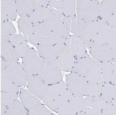 Immunohistochemistry-Paraffin: CYP51A1 Antibody [NBP2-48733]