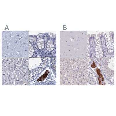 Immunohistochemistry-Paraffin: CYP51A1 Antibody [NBP2-48733]