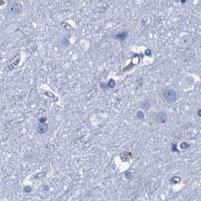Immunohistochemistry-Paraffin: CYP51A1 Antibody [NBP2-48733]