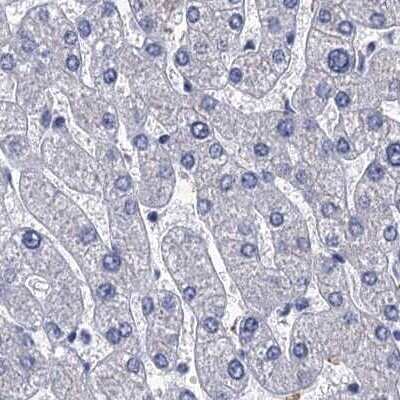 Immunohistochemistry-Paraffin: CYP51A1 Antibody [NBP2-48733]