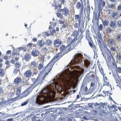 Immunohistochemistry-Paraffin: CYP51A1 Antibody [NBP2-48733]