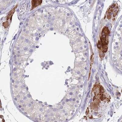 Immunohistochemistry-Paraffin: CYP51A1 Antibody [NBP2-48793]