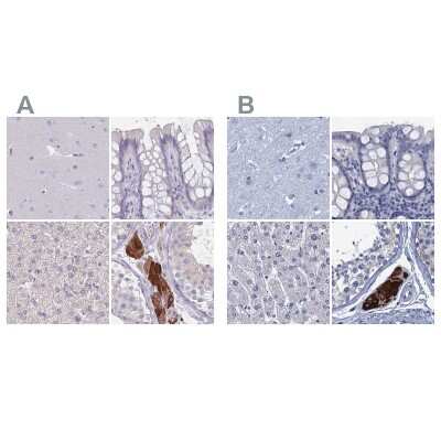 Immunohistochemistry-Paraffin: CYP51A1 Antibody [NBP2-48793]