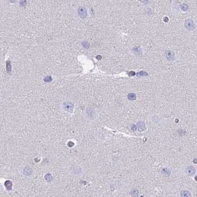 Immunohistochemistry-Paraffin: CYP51A1 Antibody [NBP2-48793]