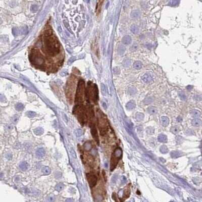 Immunohistochemistry-Paraffin: CYP51A1 Antibody [NBP2-48793]