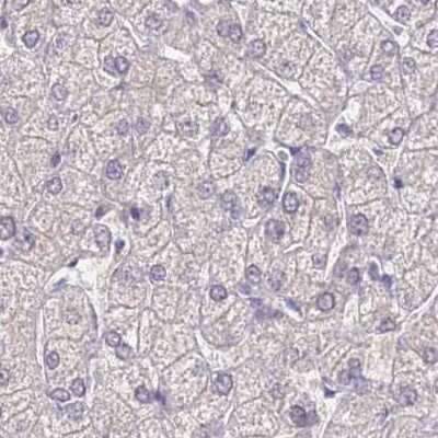 Immunohistochemistry-Paraffin: CYP51A1 Antibody [NBP2-48793]
