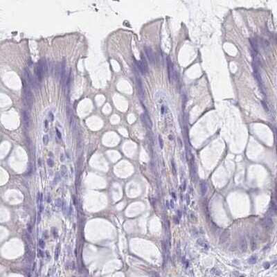 Immunohistochemistry-Paraffin: CYP51A1 Antibody [NBP2-48793]