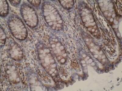 Immunohistochemistry: CYP51A1 Antibody (N6-P2H5*G8) - BSA Free [NBP2-50216]