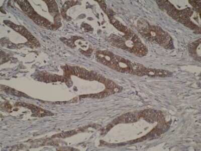 Immunohistochemistry: CYP51A1 Antibody (N6-P2H5*G8) - BSA Free [NBP2-50216]