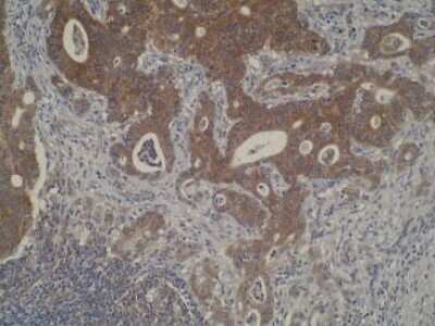 Immunohistochemistry: CYP51A1 Antibody (N6-P2H5*G8) - BSA Free [NBP2-50216]